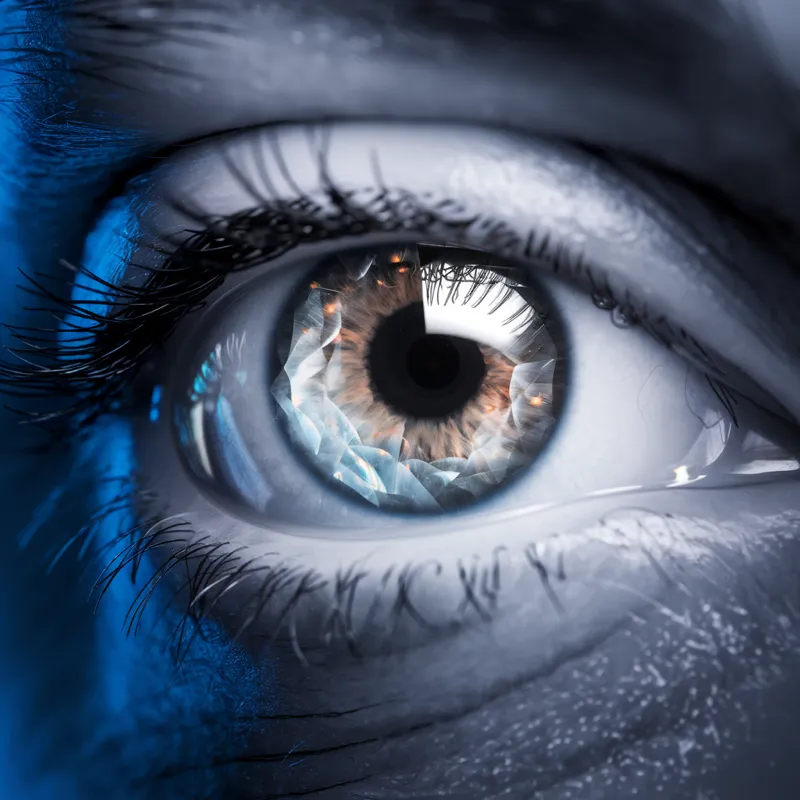 Glaucoma e neuro